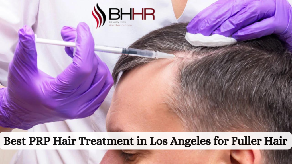 prp hair treatment los angeles